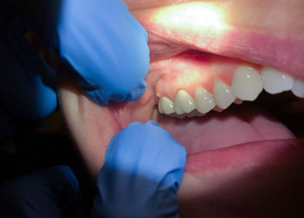 Best Broken or Cracked Tooth Emergency Dentist in Prairie Heights, WA